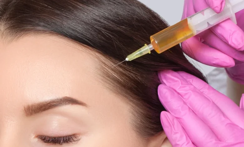 How Long Does PRP Hair Treatment Take to Show Results
