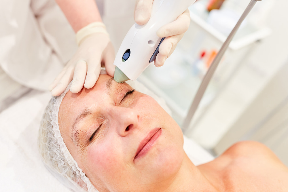 Some of the many reasons why Ultherapy treatment is becoming increasingly popular