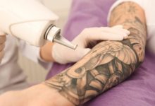 Tattoo Removal: A Quick Guide to Removing Unwanted Ink